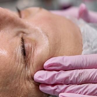 autocuidado-self-care-para-a-pele-madura-mulher- em- procedimento-estético