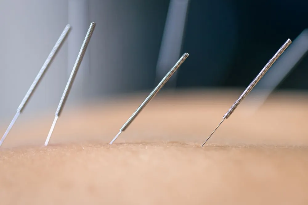 instrumentos de realizar acupuntura